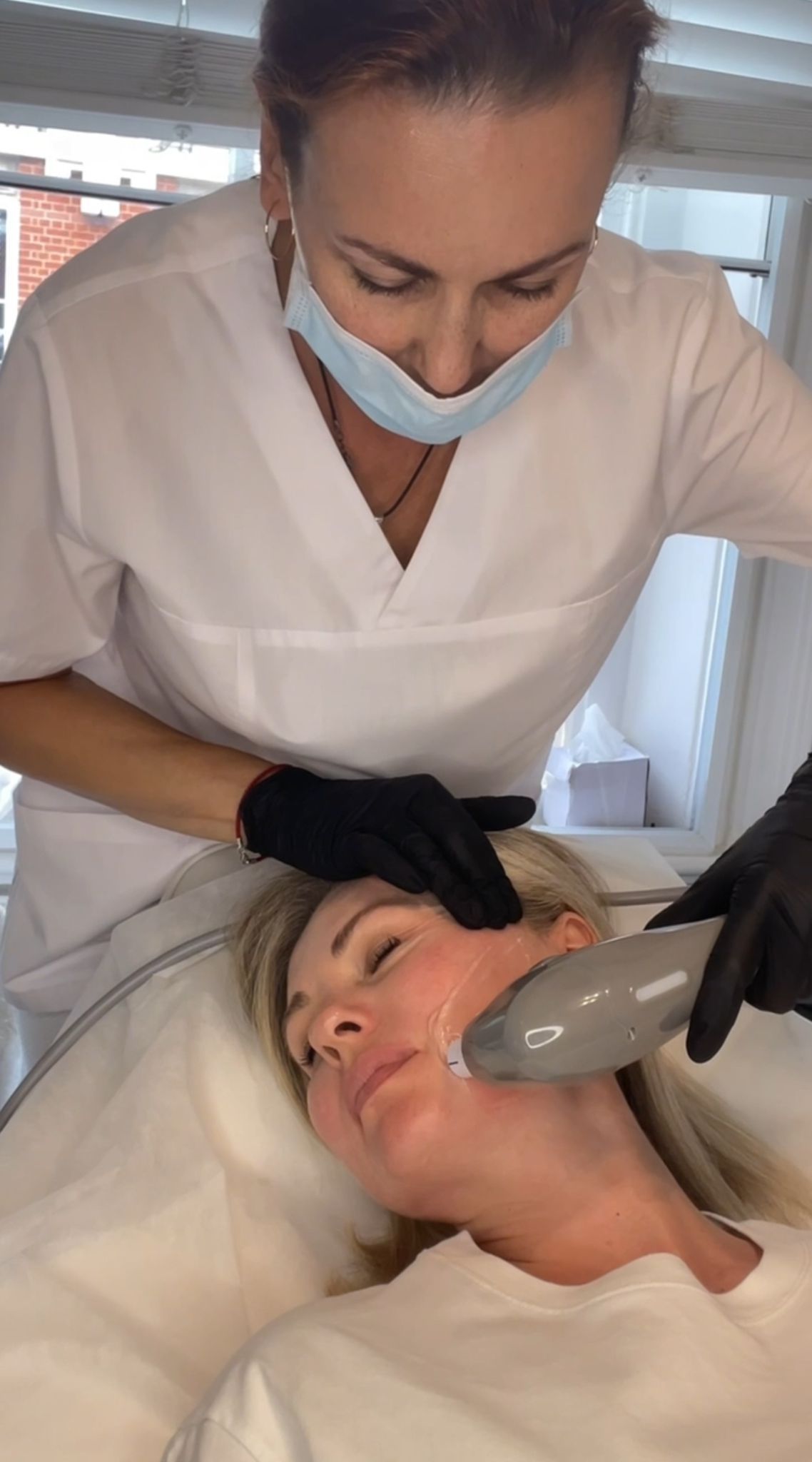 HIFU face and neck treatment at Dr Olga Nos Clinic